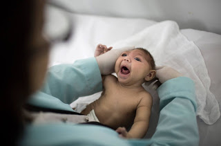 Ministério da Saúde declara fim da emergência em saúde pública por zika e microcefalia